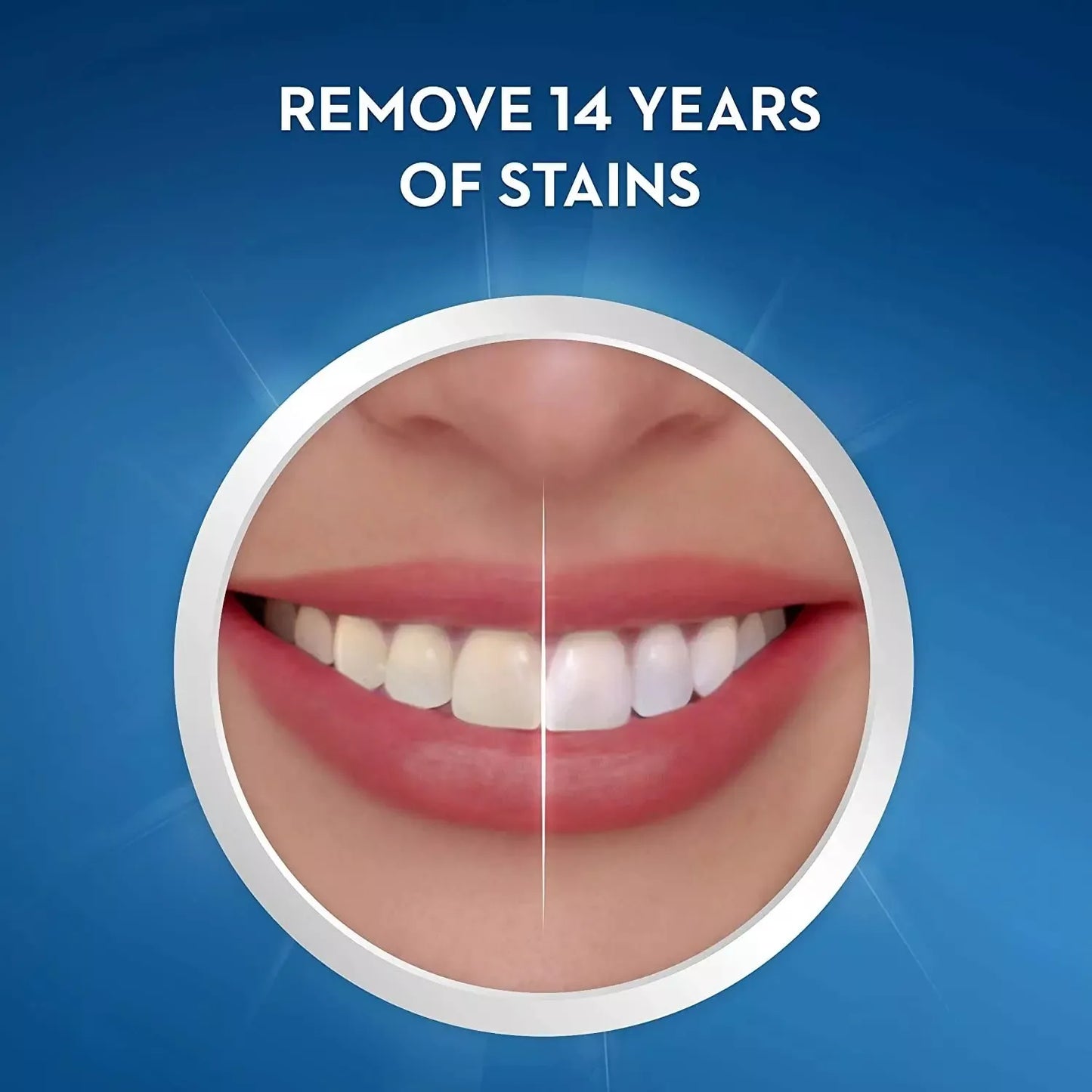 CREST 3D WHITESTRIPS PROFESSIONAL TRANSFORMATION 1 TREATMENT (45MIN)